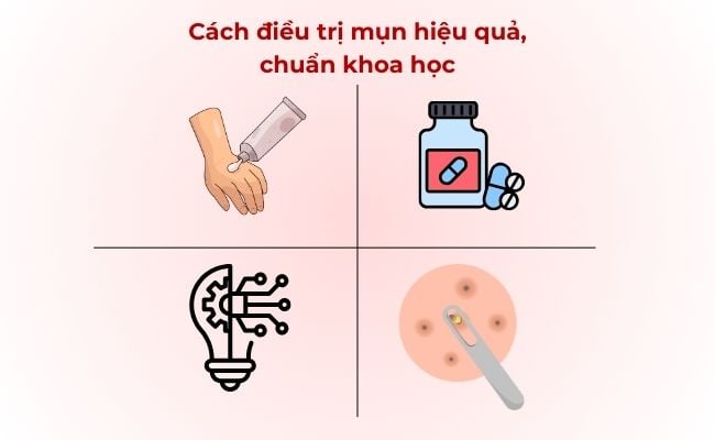 Cách điều trị mụn hiệu quả, chuẩn khoa học
