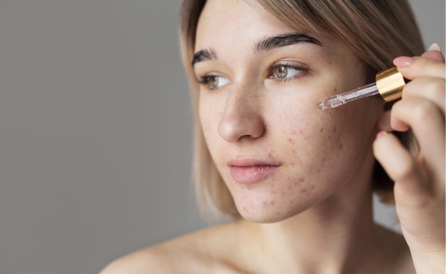 Serum dưỡng ẩm ở dạng lỏng serum dưỡng ẩm cho da mụn