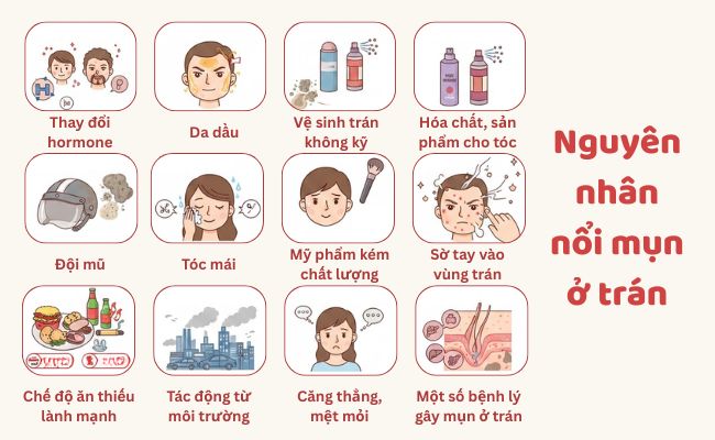 Nổi mụn ở trán nguyên nhân do đâu?