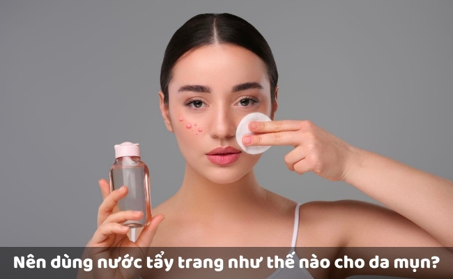 Nên dùng nước tẩy trang như thế nào cho da mụn?