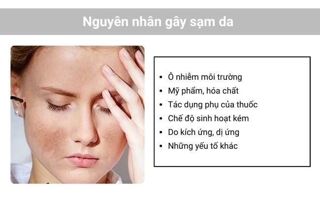 Vì sao lại bị sạm da