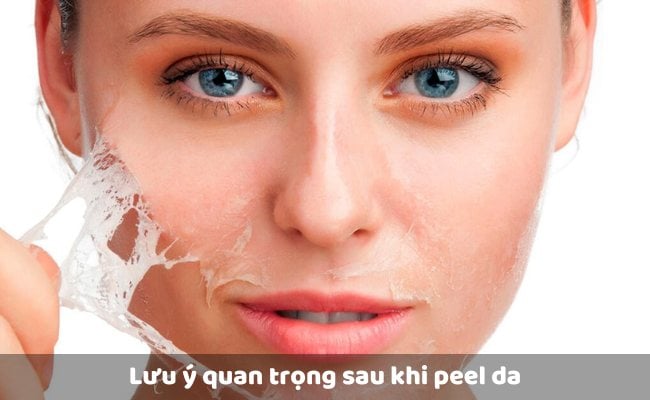 Lưu ý quan trọng sau khi peel da

