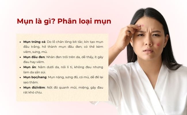 Mụn là gì? Phân loại mụn phổ biến
