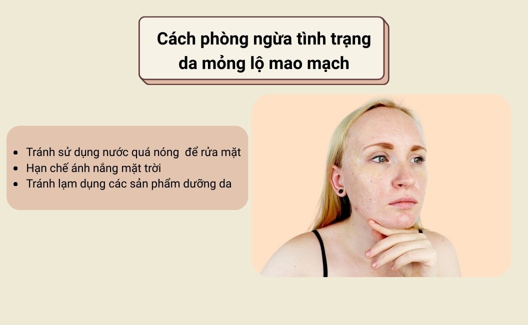 Cách phòng ngừa tình trạng da mỏng lộ mao mạch