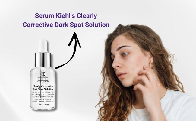 Gợi ý sản phẩm trị mụn thâm an toàn, hiệu quả từ Kiehl’s