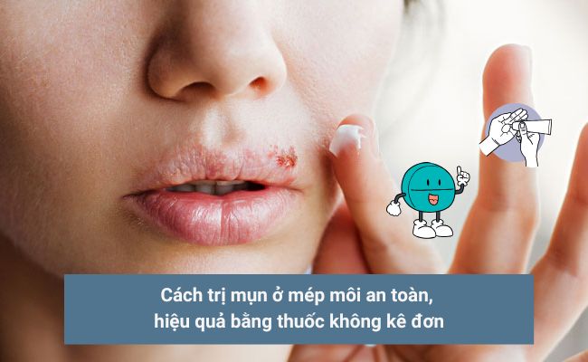 Các cách trị mụn ở mép môi hiệu quả nhanh chóng 6