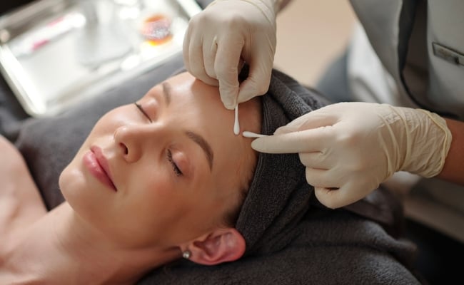 Nặn mụn có tác dụng gì? Có nên nặn mụn không?