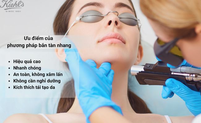 Ưu điểm của phương pháp bắn tàn nhang