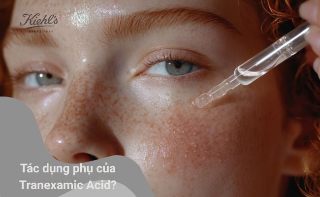 Tác dụng phụ của Tranexamic Acid?