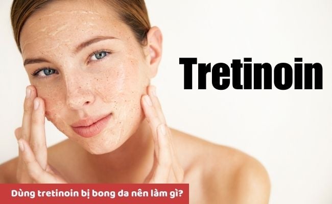 Một số câu hỏi liên quan đến Tretinoin