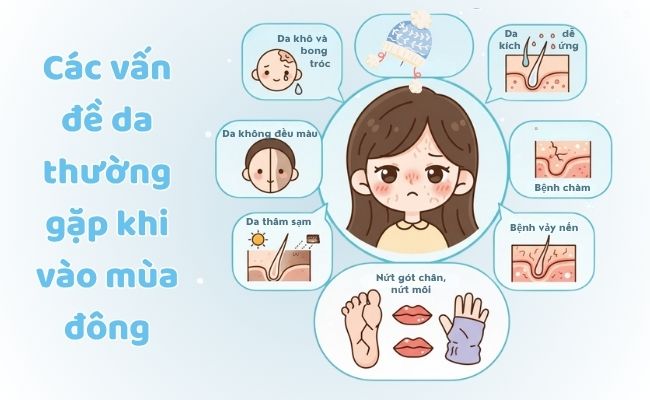 Các vấn đề da thường gặp khi vào mùa đông