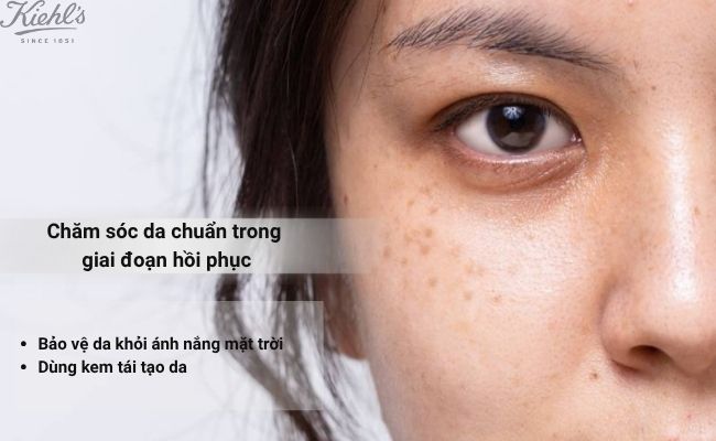 Chăm sóc da chuẩn trong giai đoạn hồi phục