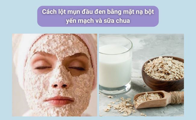 Cách lột mụn đầu đen tại nhà đơn giản, hiệu quả