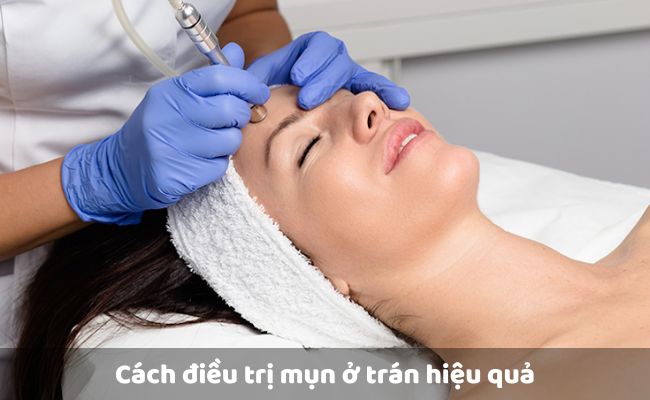 Điện di tinh chất

