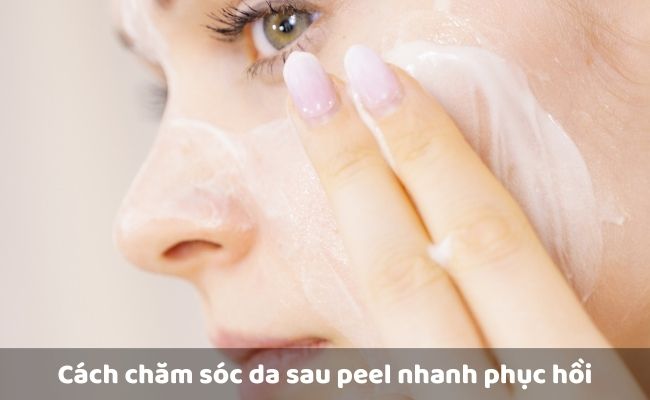 Cách chăm sóc da sau peel nhanh phục hồi