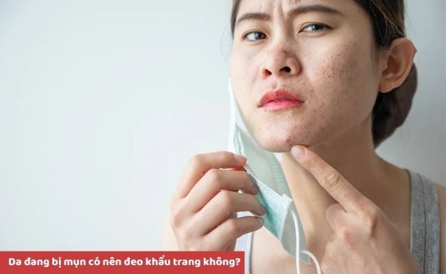Da đang bị mụn có nên đeo khẩu trang không?