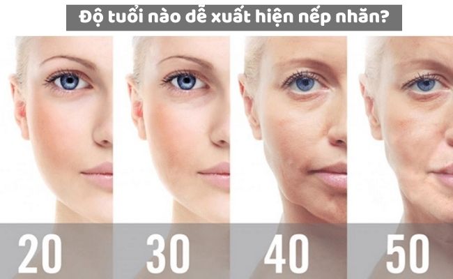 Độ tuổi nào dễ xuất hiện nếp nhăn?