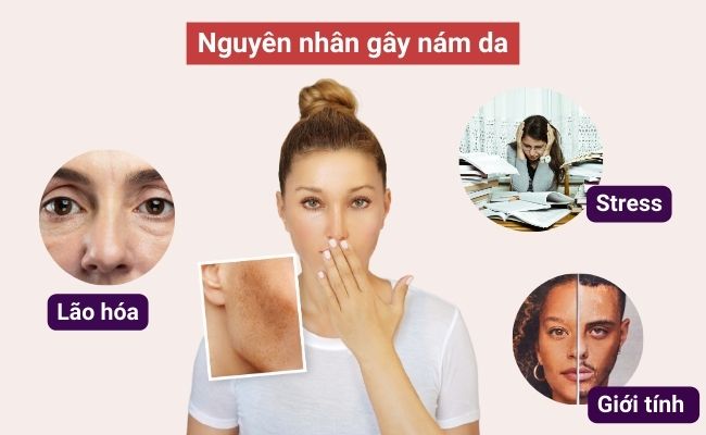 Nguyên nhân và những yếu tố nào dẫn đến tình trạng nám da?