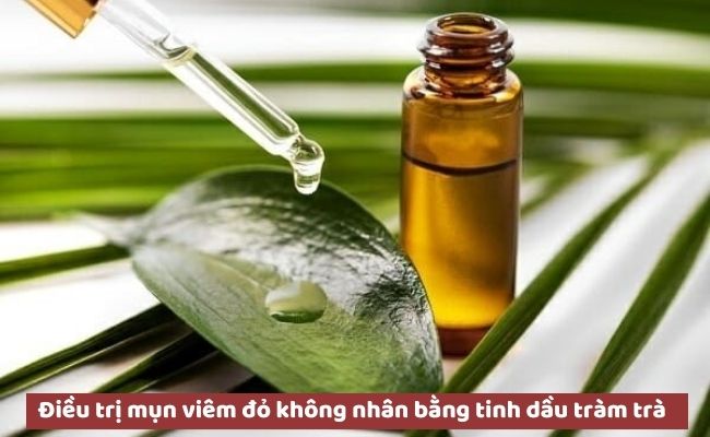 Cách trị mụn không nhân an toàn, hiệu quả