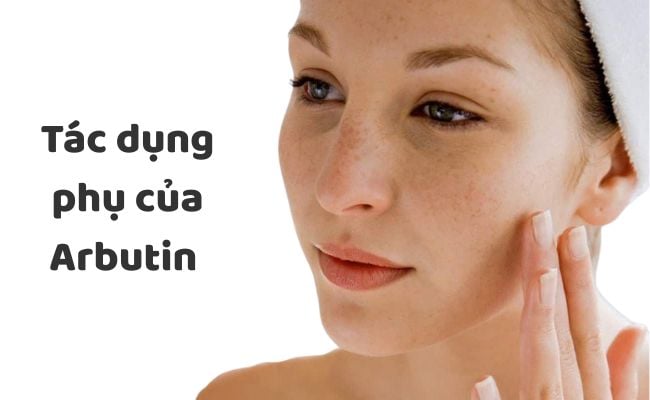 Tác dụng phụ của Arbutin