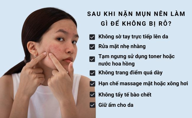 Sau khi nặn mụn nên làm gì để không bị rỗ