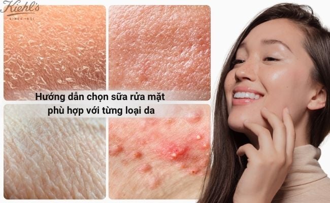 Hướng dẫn chọn sữa rửa mặt phù hợp với từng loại da