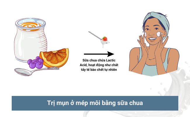 Các cách trị mụn ở mép môi hiệu quả nhanh chóng 5