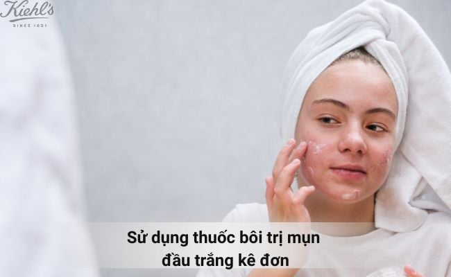 Sử dụng các loại thuốc uống, thuốc bôi trị mụn đầu trắng kê đơn