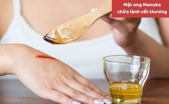 Lợi ích của mật ong Manuka là gì?