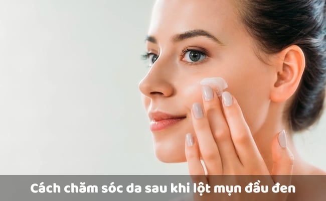 Cách chăm sóc da sau khi lột mụn