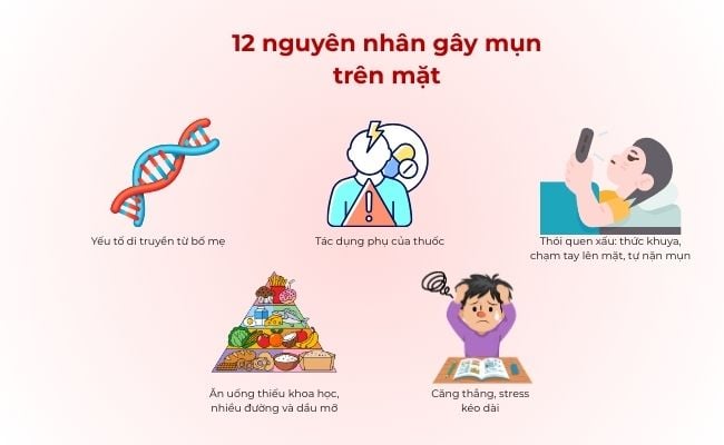 12 nguyên nhân gây mụn trên mặt phổ biến
