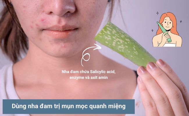 Các cách trị mụn ở mép môi hiệu quả nhanh chóng 3