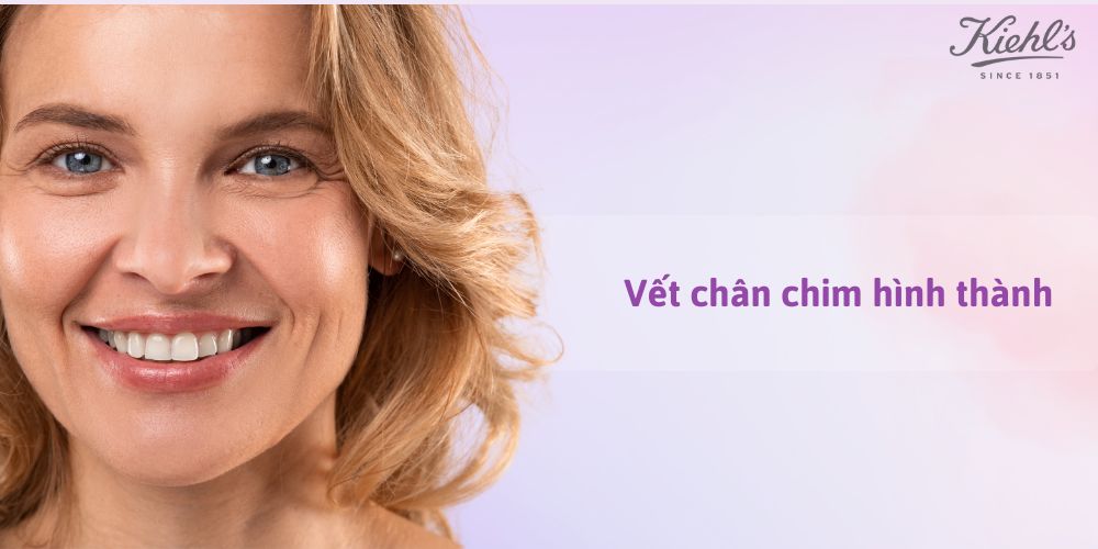 14 dấu hiệu lão hóa da thường gặp