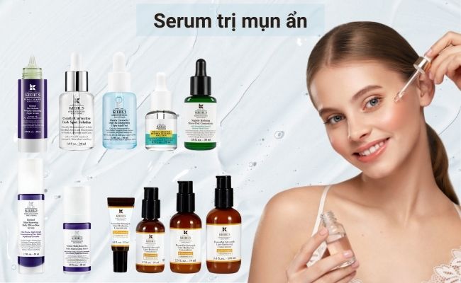 Serum trị mụn ẩn là gì?