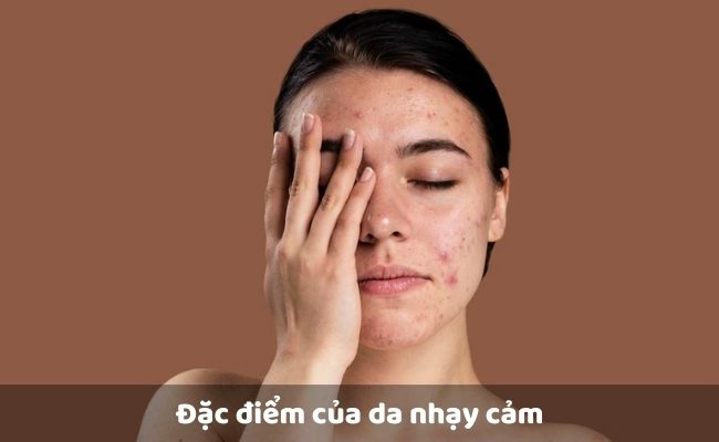 Đặc điểm của da nhạy cảm

