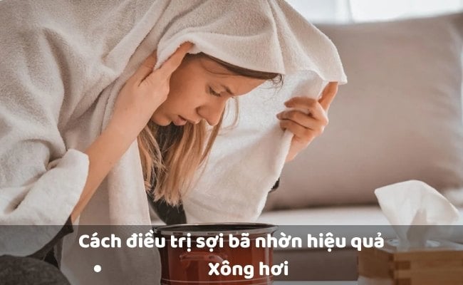 Cách điều trị sợi bã nhờn hiệu quả



