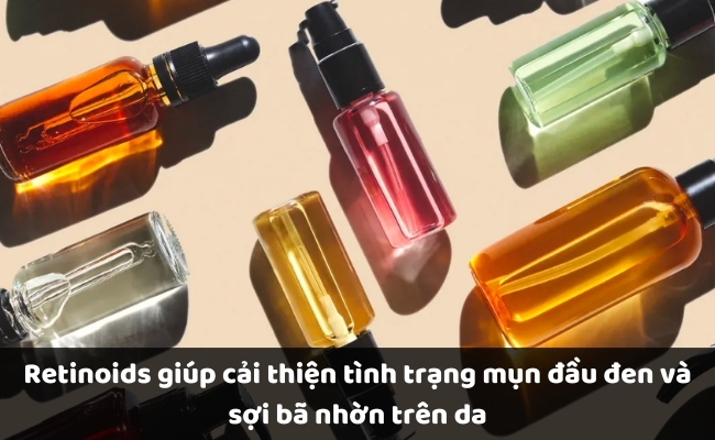 Sử dụng Retinoids cải thiện tình trạng mụn đầu đen và sợi bã nhờn trên da