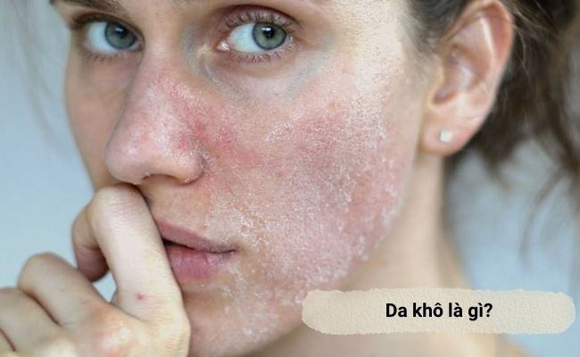 Mỹ Phẩm Dưỡng Ẩm Cho Da Khô Mỹ Phẩm Dưỡng Ẩm Cho Da Khô
