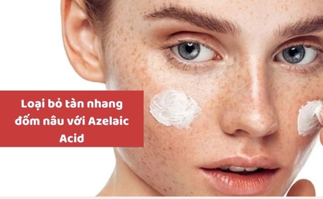 Cách trị tàn nhang tận gốc, an toàn, hiệu quả