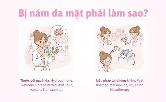 Bị nám da mặt phải làm sao?
