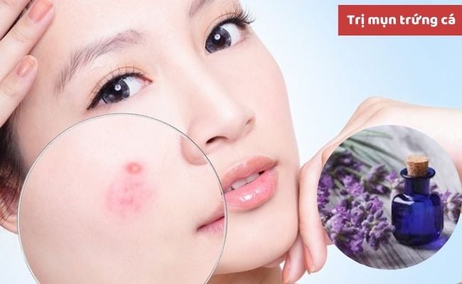 Tinh dầu hoa oải hương có tác dụng gì?
