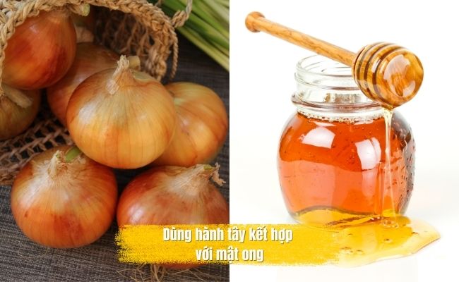 Cách để tóc mọc nhanh trong 1 tuần cho nữ bằng hành tây