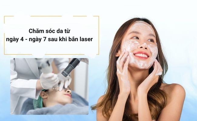 Từ ngày 4 đến ngày 7, bạn có thể dùng sản phẩm phục hồi, dưỡng ẩm và bảo vệ da sau điều trị laser