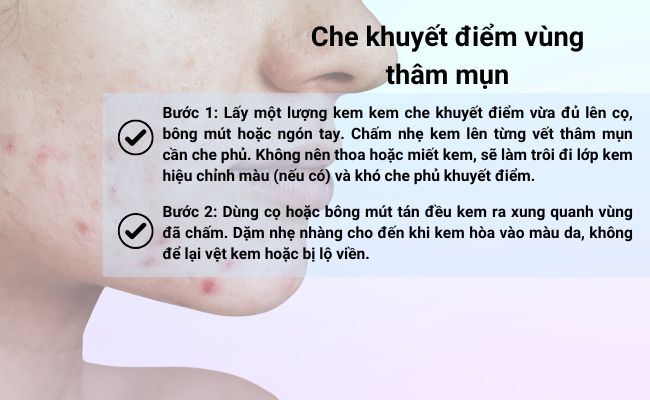 Chấm kem che khuyết điểm lên từng vết thâm