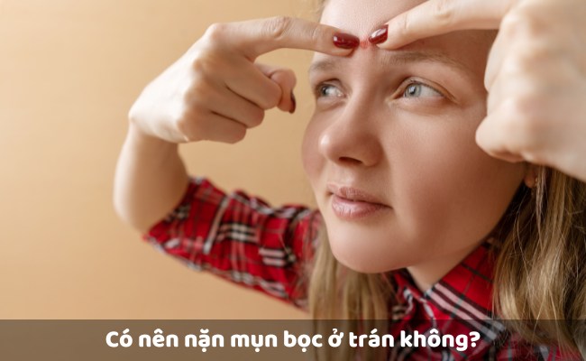 Có nên nặn mụn bọc ở trán không?