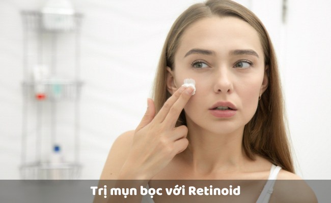 Trị mụn bọc với Retinoid

