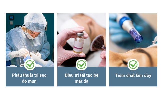 20+ cách trị sẹo mụn 4