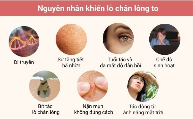 Nguyên nhân lỗ chân lông to