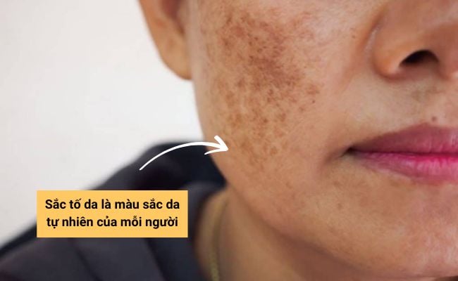 Sắc tố da là gì?