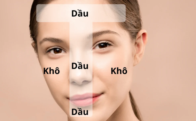 Da Hỗn Hợp Thiên Dầu Là Gì? Quy Trình Chăm Sóc Da